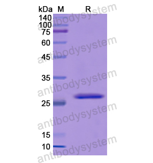 ITPRID2,Recombinant Human ITPRID2, N-His