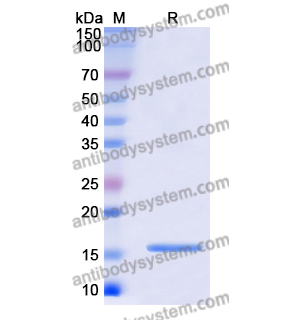 CST5,Recombinant Human CST5, N-His