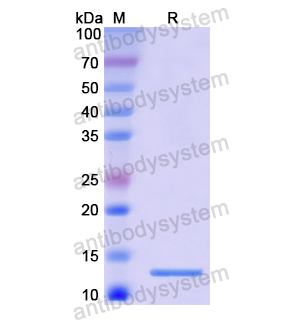 PEX2,Recombinant Human PEX2, N-His