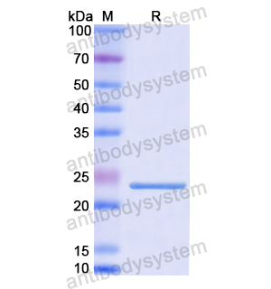 NDUFS1,Recombinant Human NDUFS1, N-His