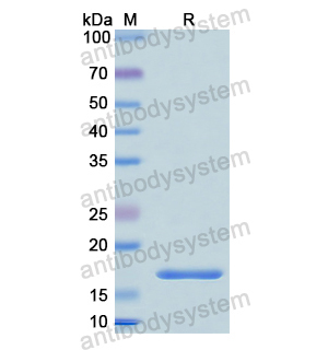 GCA,Recombinant Human GCA, N-His