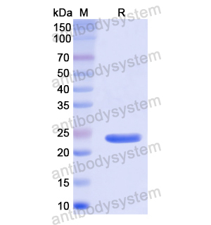 LAP3,Recombinant Human LAP3, N-His