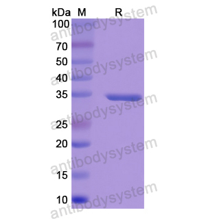 HSD11B1,Recombinant Human HSD11B1, N-His