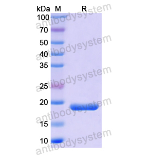 CRABP2,Recombinant Human CRABP2, N-His