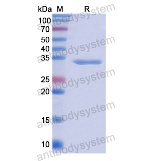 TKT,Recombinant Human TKT, N-His