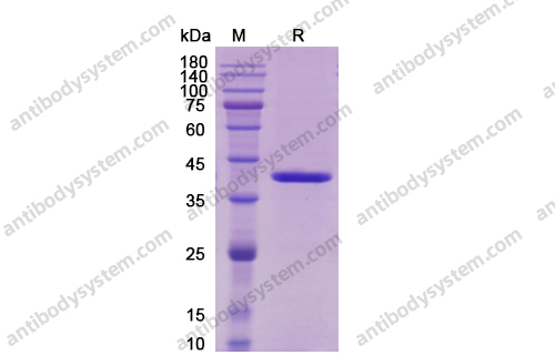 IL12B/IL-12,Recombinant Human IL12B/IL-12 p40/NKSF2, C-Flag