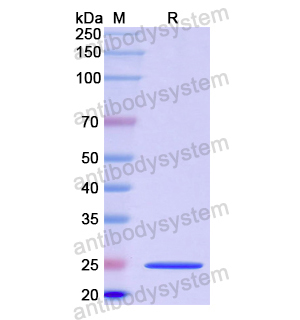 NOS1,Recombinant Human NOS1, N-His