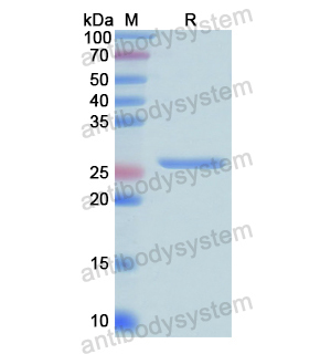 SERPINB3,Recombinant Human SERPINB3, N-His