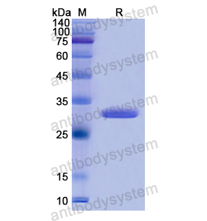 TYK2,Recombinant Human TYK2, N-His