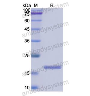 CRABP1,Recombinant Human CRABP1, N-His