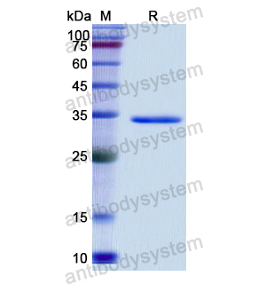 AQP1,Recombinant Human AQP1, N-GST