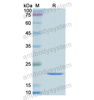 ATP5F1D,Recombinant Human ATP5F1D, N-His