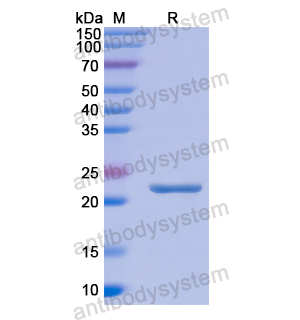 PEBP1,Recombinant Human PEBP1, N-His