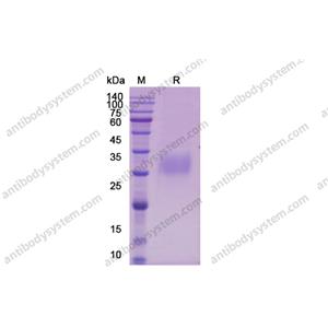 Recombinant Mouse IL12A/IL-12 p35/NKSF1, C-His