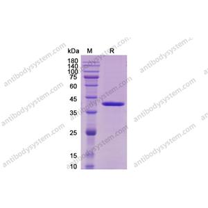 Recombinant Human IL12B/IL-12 p40/NKSF2, C-Flag