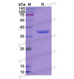 ADSL,Recombinant Human ADSL, N-His