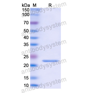 CORO1A,Recombinant Human CORO1A, N-His