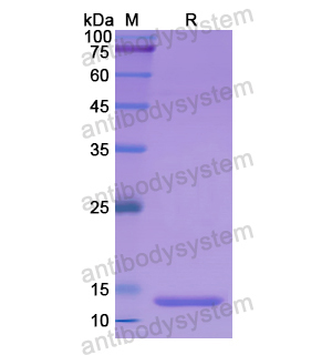 S100A7,Recombinant Human S100A7, N-His