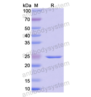 FGF9,Recombinant Human FGF9, N-His