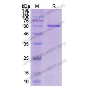 AKT1,Recombinant Human AKT1, N-His