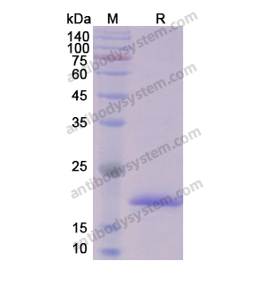 AKT2,Recombinant Human AKT2, N-His