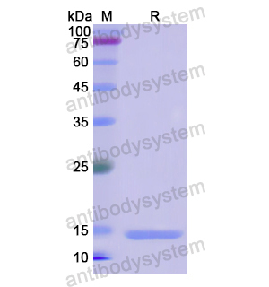 S100A11,Recombinant Human S100A11, N-His