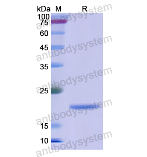 CD32b,Recombinant Human CD32b/FCGR2B, N-His