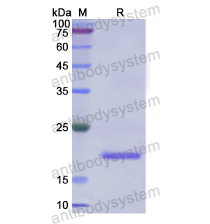 PRDX2,Recombinant Human PRDX2, N-His