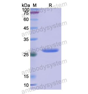 CD191,Recombinant Human CD191/CCR1, N-GST