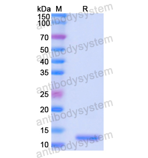 CD197/CCR7,Recombinant Human CD197/CCR7, N-His