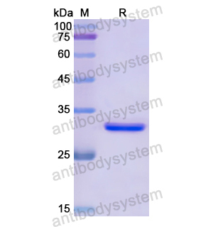 GRK4,Recombinant Human GRK4, N-His