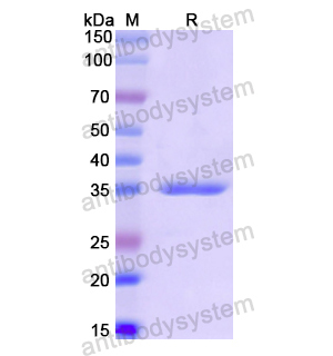 PYCR1,Recombinant Human PYCR1, N-His