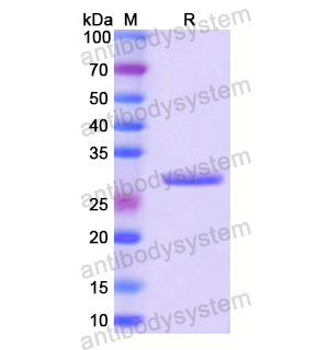 GTF2H1,Recombinant Human GTF2H1, N-His