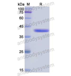 DSG3,Recombinant Human DSG3, N-GST