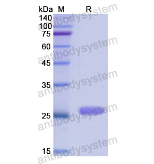 CTH,Recombinant Human CTH, N-His