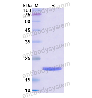 CD153/TNFSF8,Recombinant Human CD153/TNFSF8, N-His