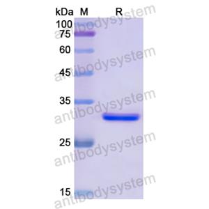 GRK4,Recombinant Human GRK4, N-His