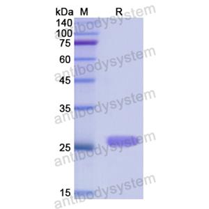 Recombinant Human CTH, N-His