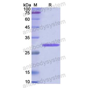 Recombinant Human CD144/CDH5, N-His