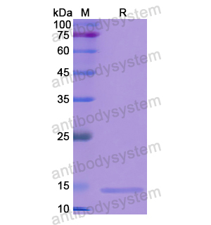 S100A3,Recombinant Human S100A3, N-His