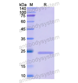 MCM5,Recombinant Human MCM5, N-His