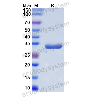 CD68,Recombinant Human CD68, N-His