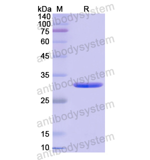 RYK,Recombinant Human RYK, N-His