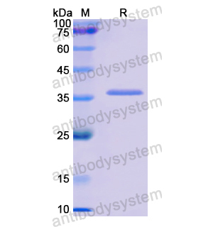 GPC1,Recombinant Human GPC1, N-His