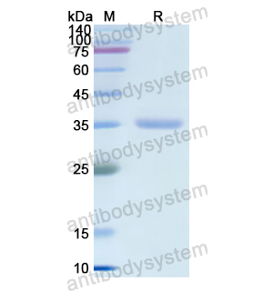 CA8,Recombinant Human CA8, N-His