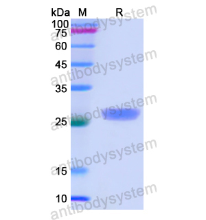 CTNNA1,Recombinant Human CTNNA1, N-His