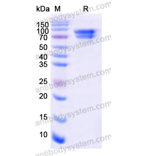 CTNNB1,Recombinant Human CTNNB1, N-His