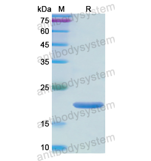 NOS2,Recombinant Human NOS2, N-His