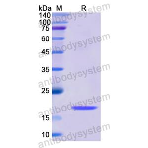 Recombinant Human BMP8B, N-His