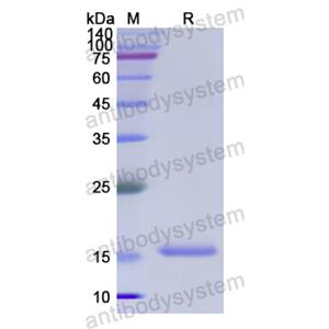 Recombinant Human PFN2, N-His